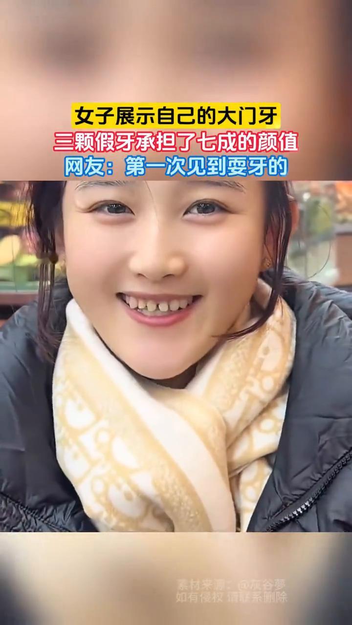 女子展示自己的大门牙，三颗假牙承担了七成的颜值。网友：第一次见到耍牙的。
素材来