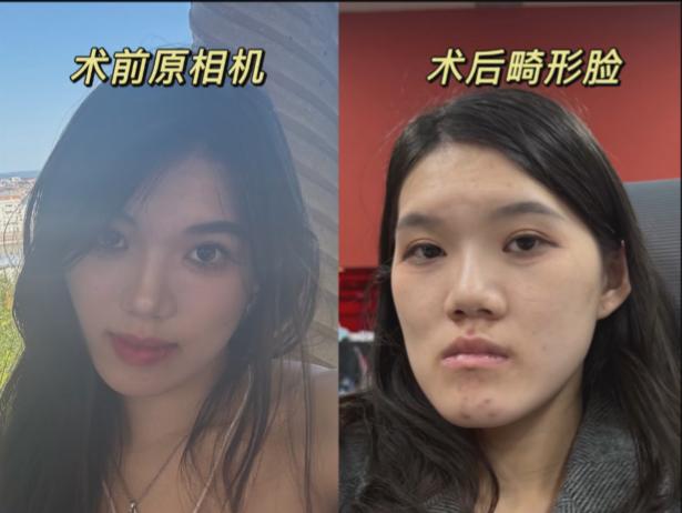武汉大学某医院医生你良心不会痛吗？人家本来也算是姿色中等偏上的一美女吧，花个大几