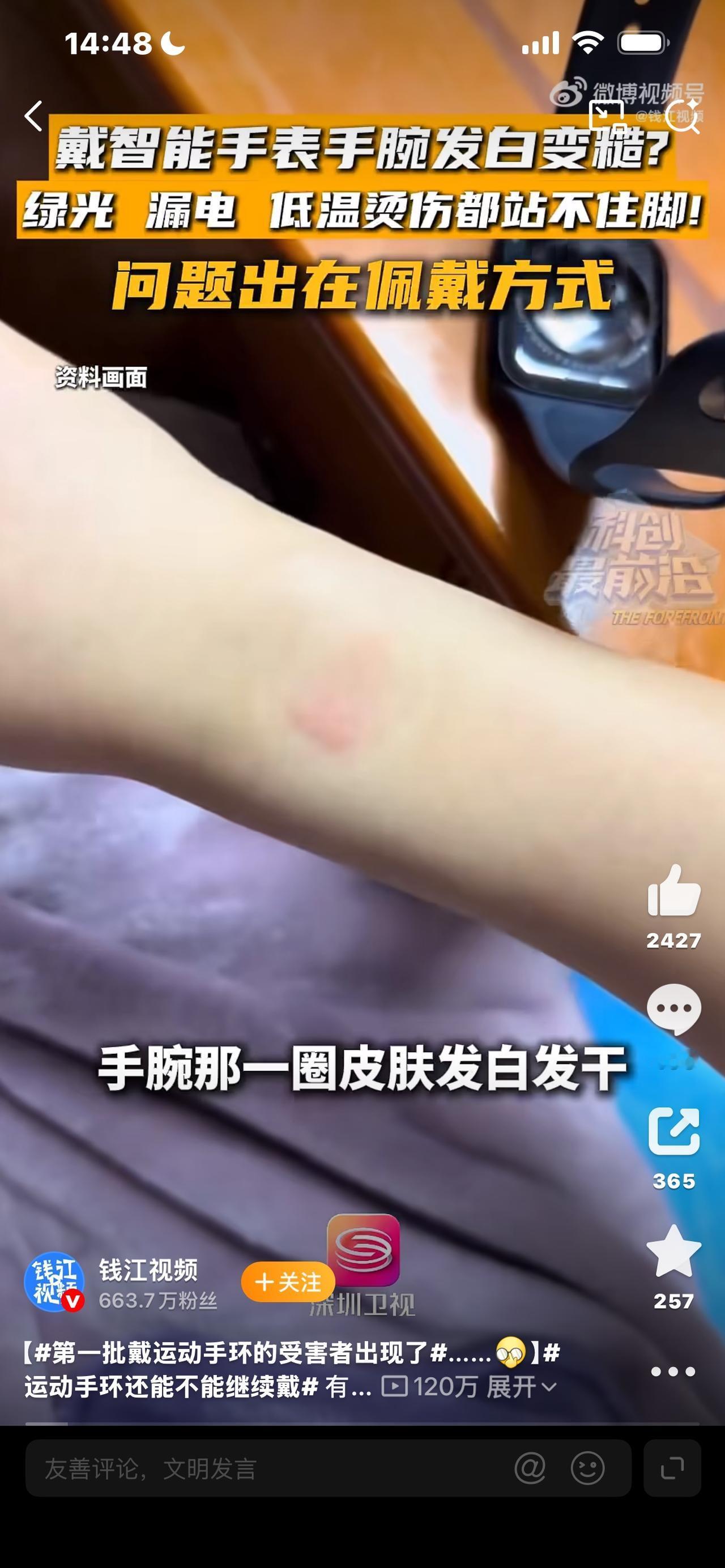 第一批戴运动手环的受害者出现了

你是不是也是这样？运动手环、智能手表一戴上，就
