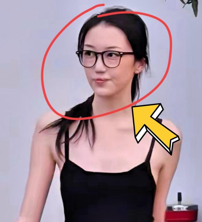 不得不承认！家庭条件，实实在在改写了李嫣的人生！
 
唇腭裂并不是一次手术就能够