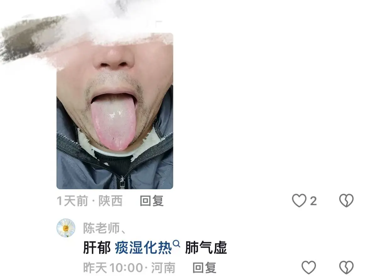 现在不忙，专门抽出时间来辨证舌苔，赶紧发立马看！ 1.脾虚，肺部有淤堵...