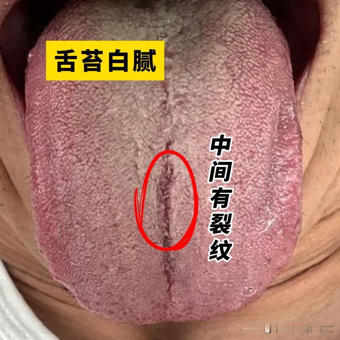门诊32岁的赵先生，手淫史16年，能涨大，但是疲软[狗头][狗头][狗头]
每天