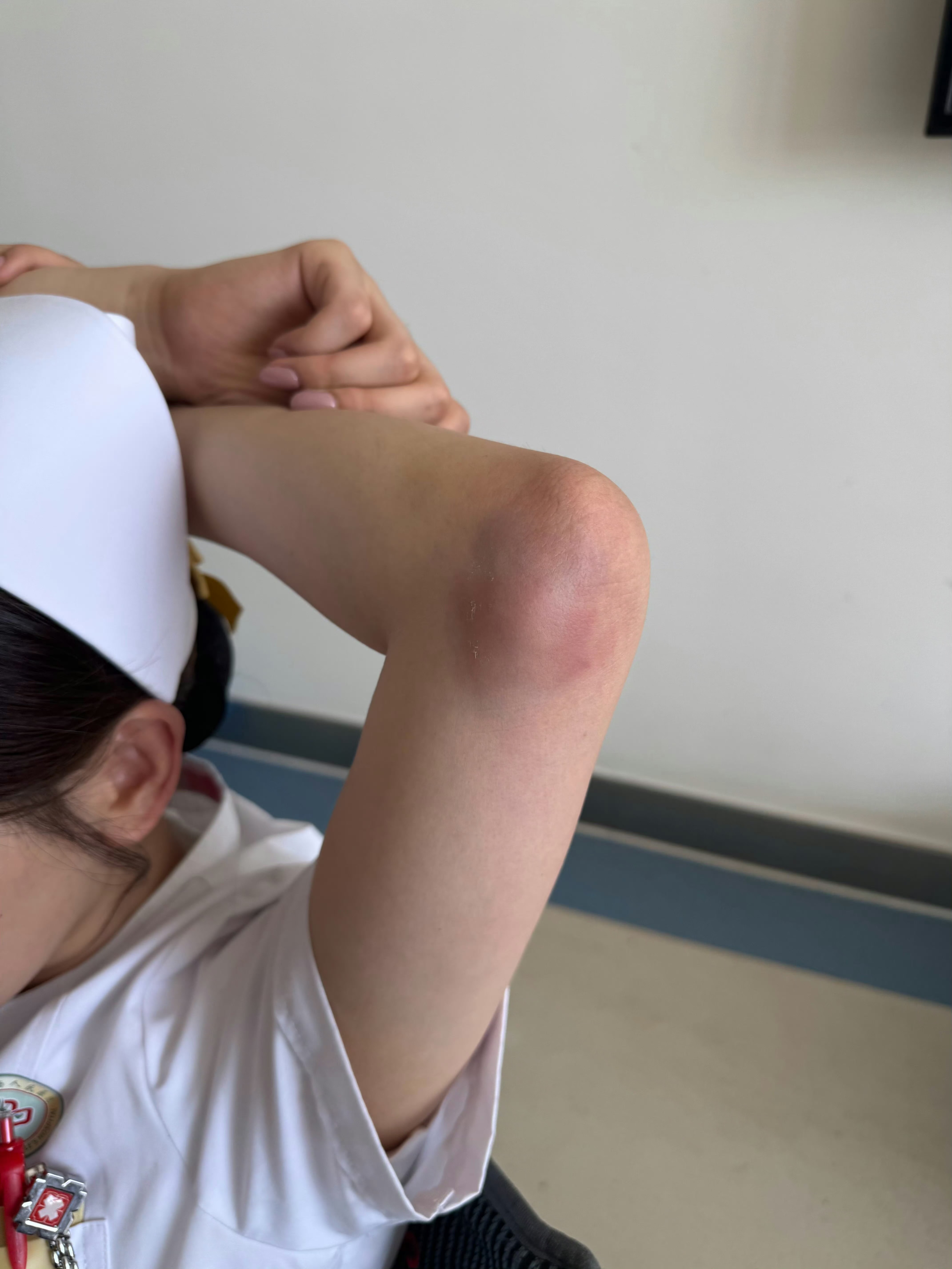 杨超越拍戏手臂大面积淤青杨超越《10间敢死队》原来这场天台的动作戏拍的这么艰难，