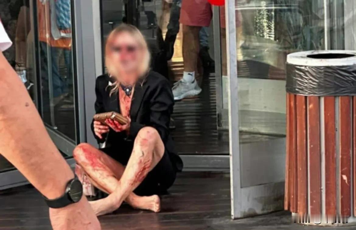 🔻一名以色列妇女用斧头杀死了自己 6 岁的孩子和一条狗，然后提着斧头袭击了位于