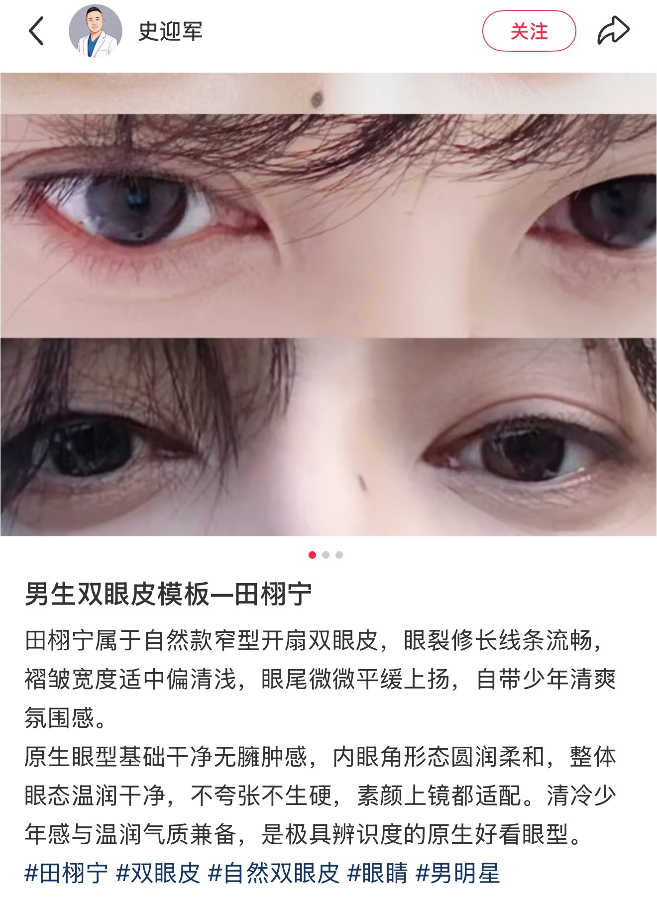 田栩宁的眼睛真的很好看 