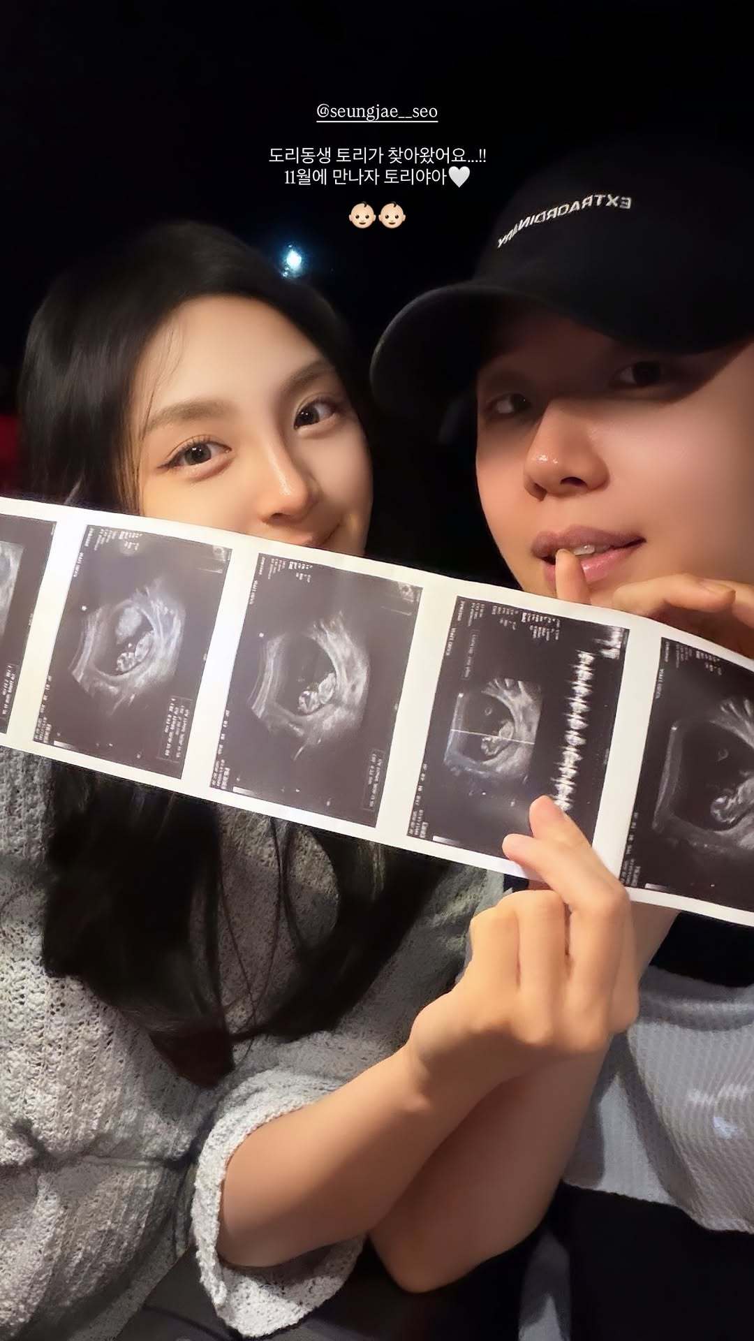 徐承宰与妻子官宣二胎，恭喜！羽毛球