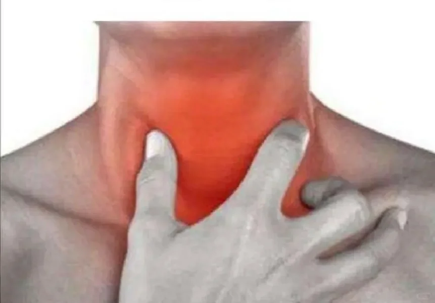 【化学消融】甲状腺囊性包块