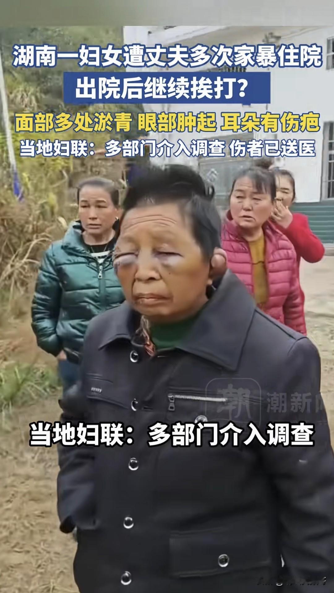 把家庭成员打成这样，我觉得用“家暴”来描述是非常不妥的，这要是放在同事、老乡甚至