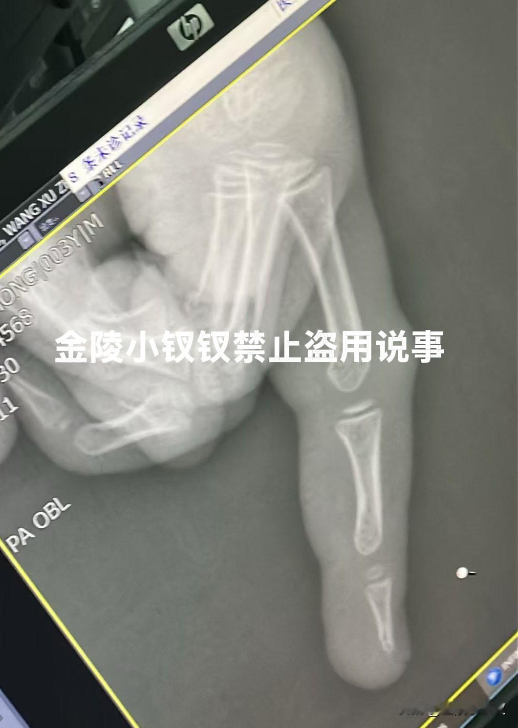那是饿的轻！

不知大家发现没有，如今无论是大人还是孩子，粮食吃的明显少了，尤其
