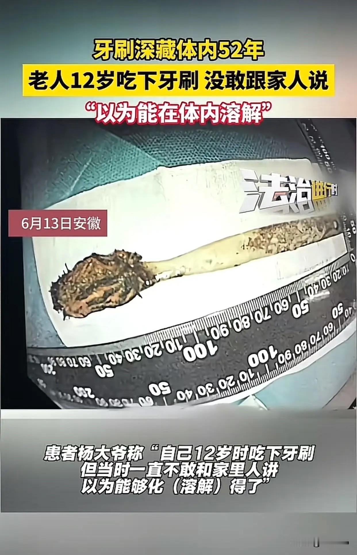 安徽六旬老汉体内惊现