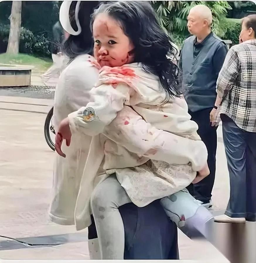 刷到那张照片

我心瞬间沉到底

比烈性犬更扎眼的

是那个左耳快被咬掉、半边脸