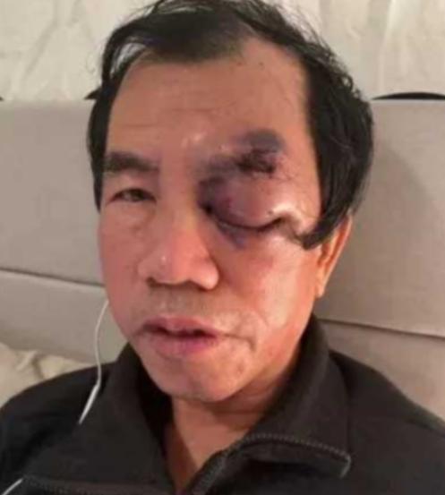 2015年，富豪梁新民带着大笔财富移民美国，在那里，每天钓鱼、游泳，生活惬意悠闲