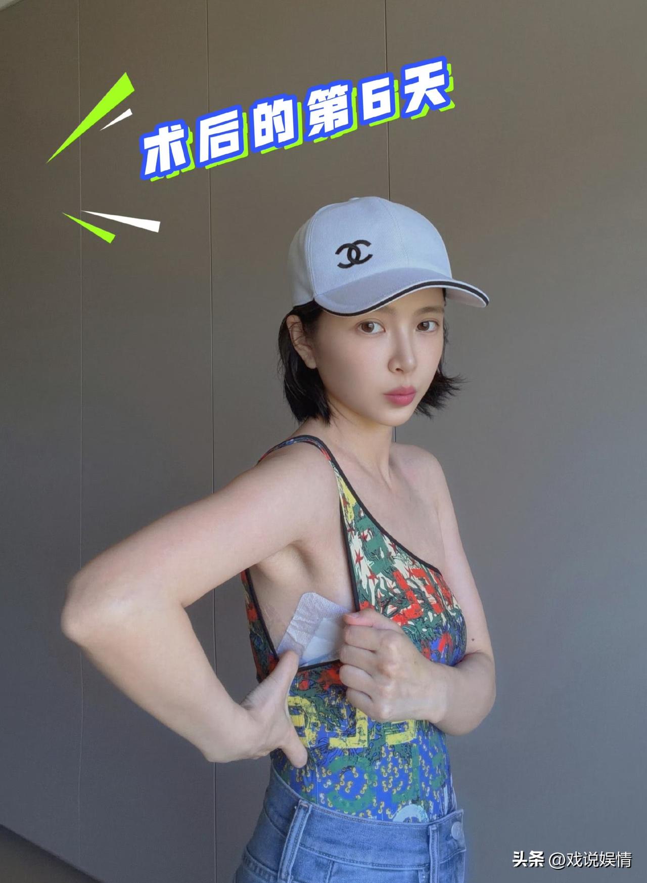 王灿出院后晒照！
5月4日，王灿晒照分享了出院后的状态。照片中的她头戴浅灰色棒球