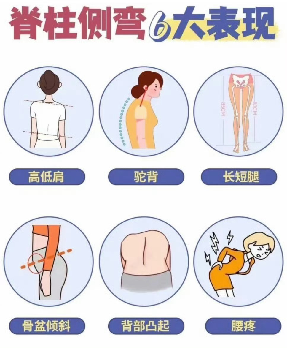 看演唱会发现自己脊柱侧弯了我都有 有空得去医院查查了 要查的地方有好多啊 十一假