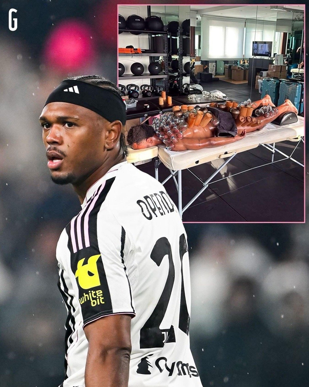 祖雲達￼斯奧賓達為咗恢復狀態 👀🇧🇪呢位斑馬軍團前鋒接受咗一次「拔罐療法」