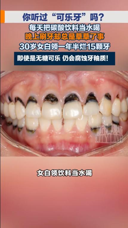 “悲剧还是发生了！”深圳，一30岁的女白领，几乎每天都要熬夜加班，为了提神，她每