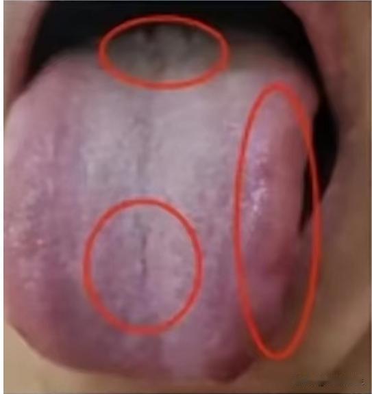 房事不行，以为是脾肾阳虚，其实有些问题在肝上。

今天看诊了一位患者，自诉房事无