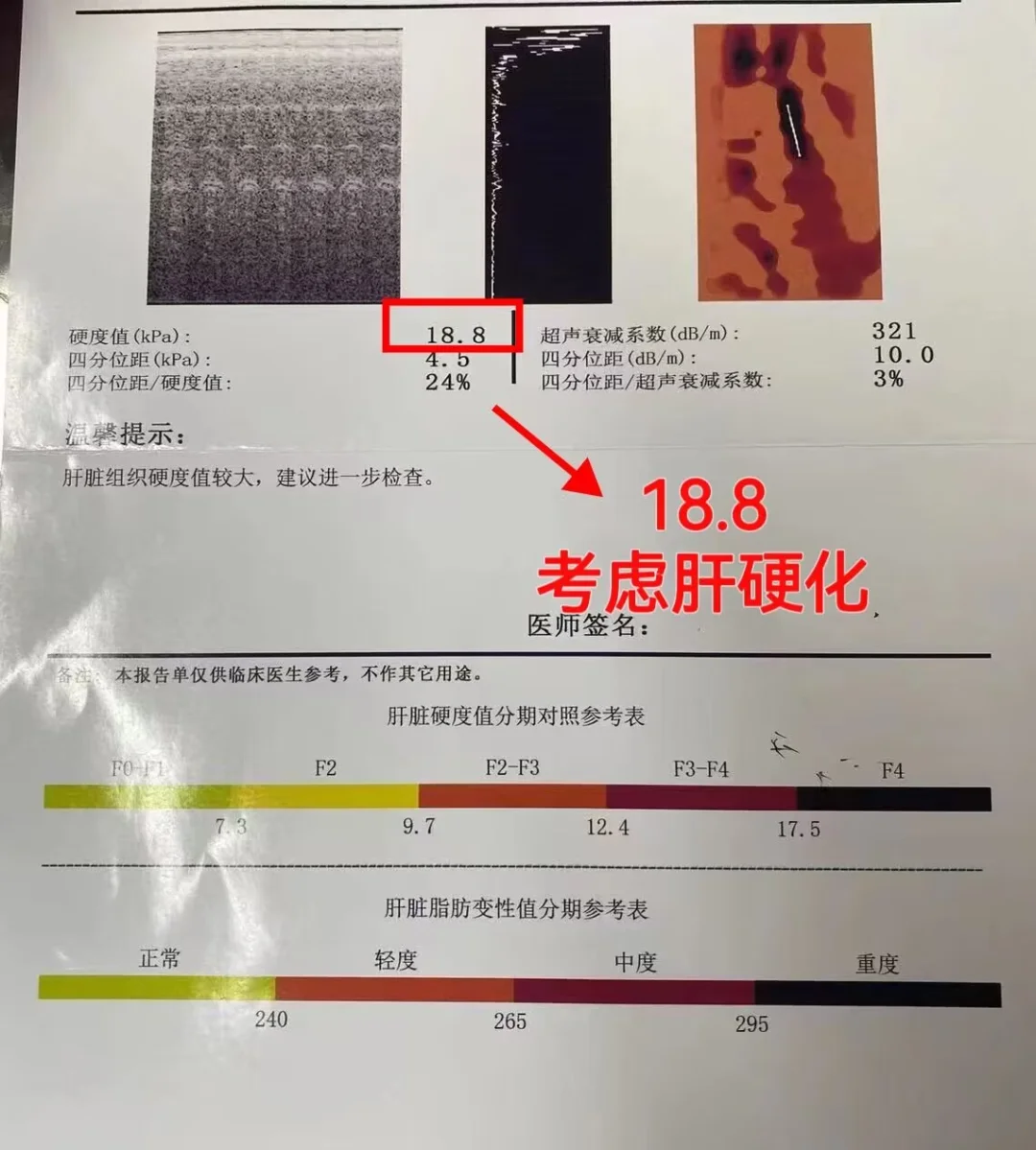 肝弹报告单不会看？医生来教你！