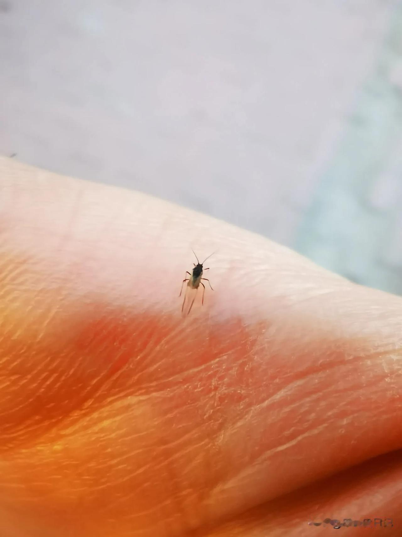 咱也不知道从什么时候开始，小咬儿已经多到往人的嘴里和眼睛上撞。今天休息出门去了一