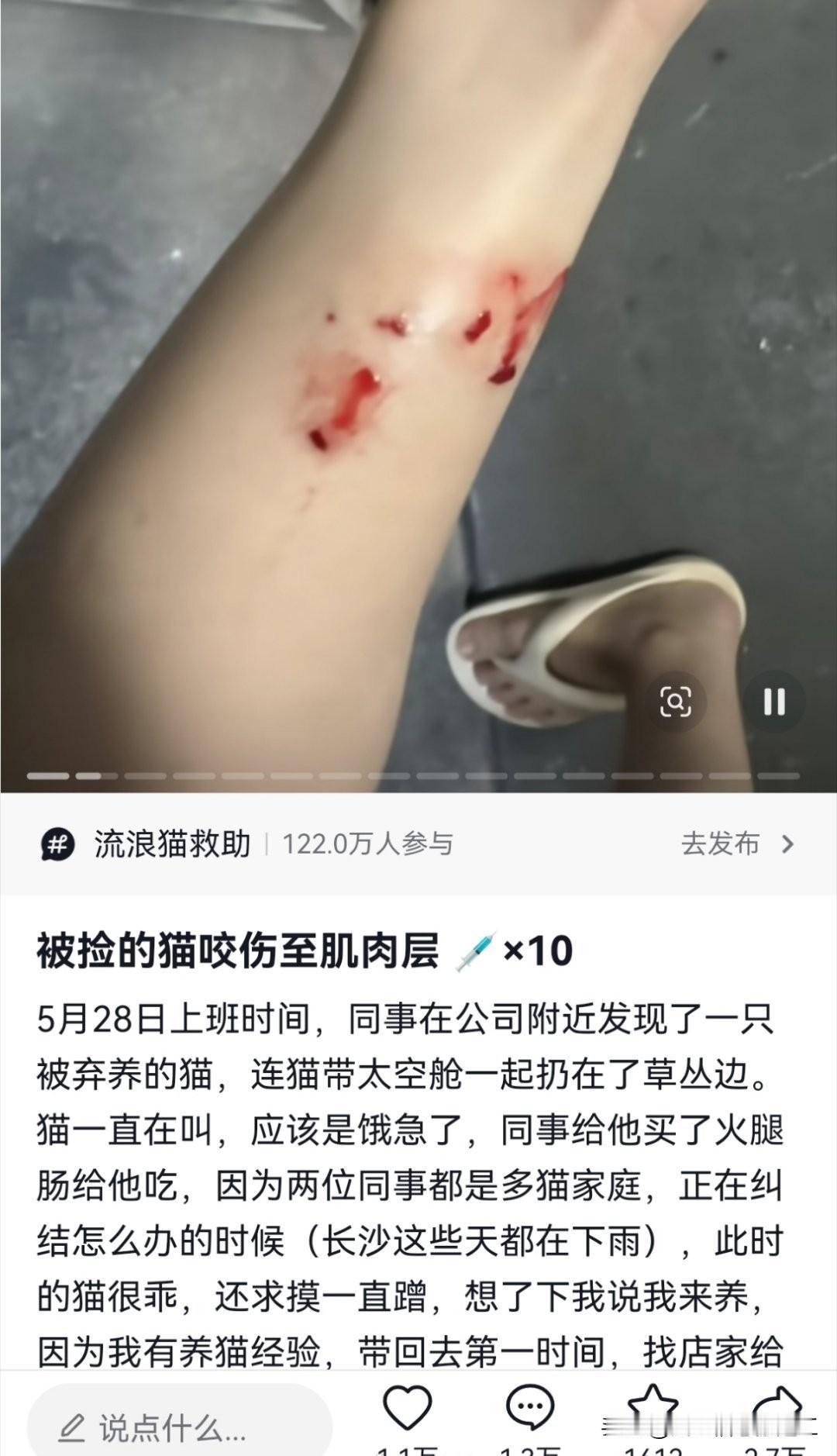 刷到一个网友被捡到的猫咬伤多处至肌肉层，破伤风+狂犬疫苗一共10针，善意可贵，但