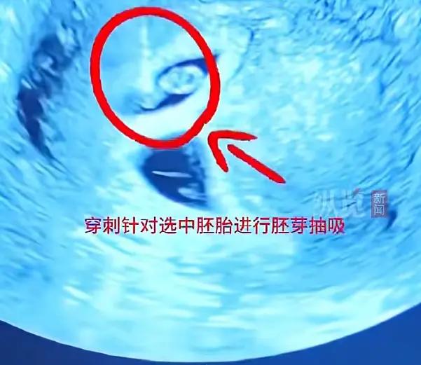 盲目跟风乱来了！
2026年4月29日，江苏淮安，备孕困难的李女士私自购买服用多
