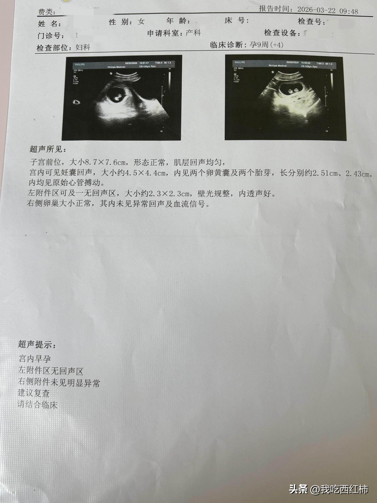 我居然怀双胞胎了
7周➕4的时候是单的，9+4发现成双的了！（原来它在很早很早就