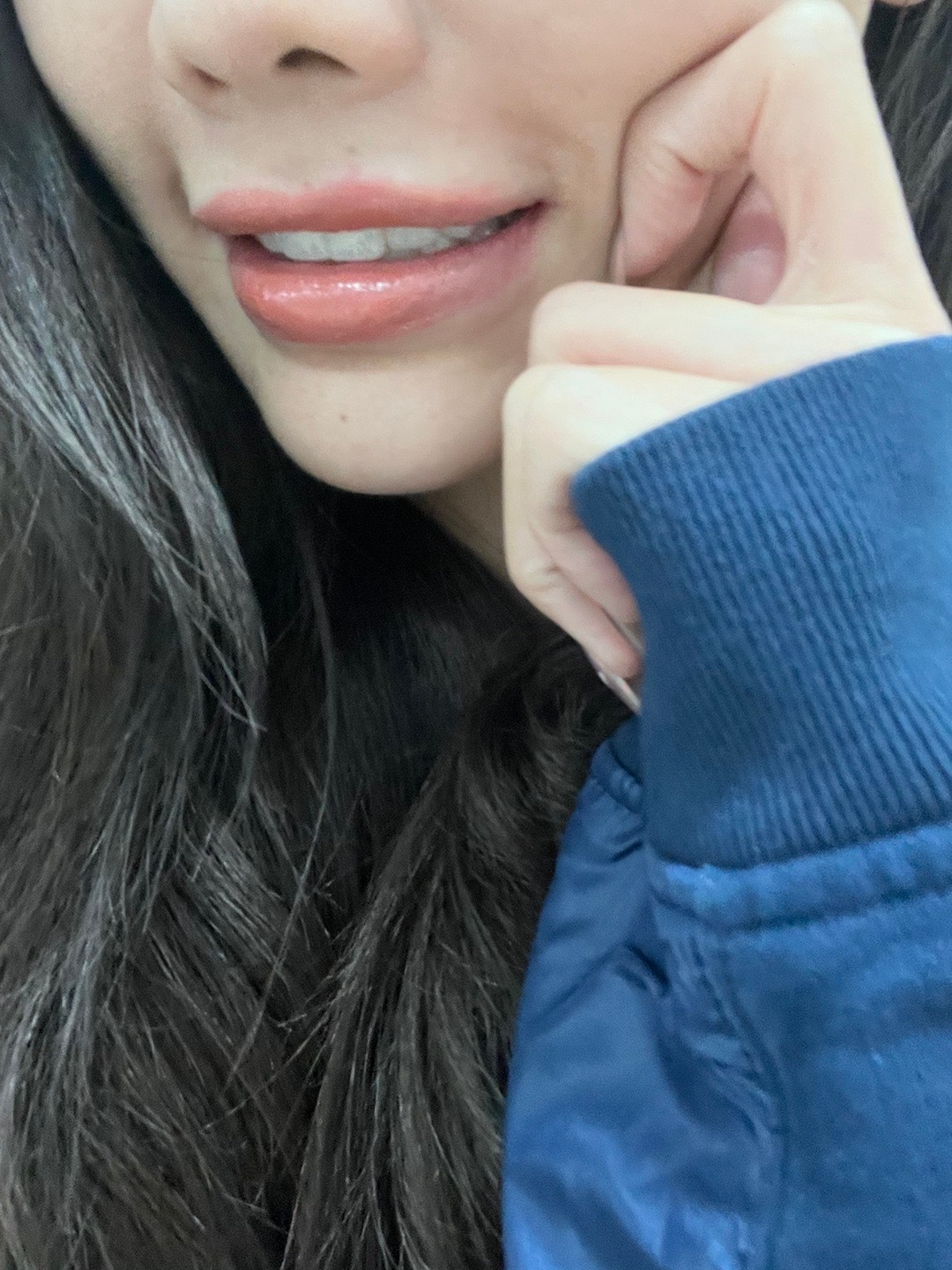 发下新的牙齿好爱！最后一张是以前的牙齿 ​​​