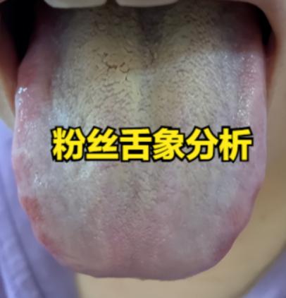 它是男科“软而不坚”的克星！上通肝郁气滞，下温肾阳散寒，硬度从萎软无力到坚挺如铁