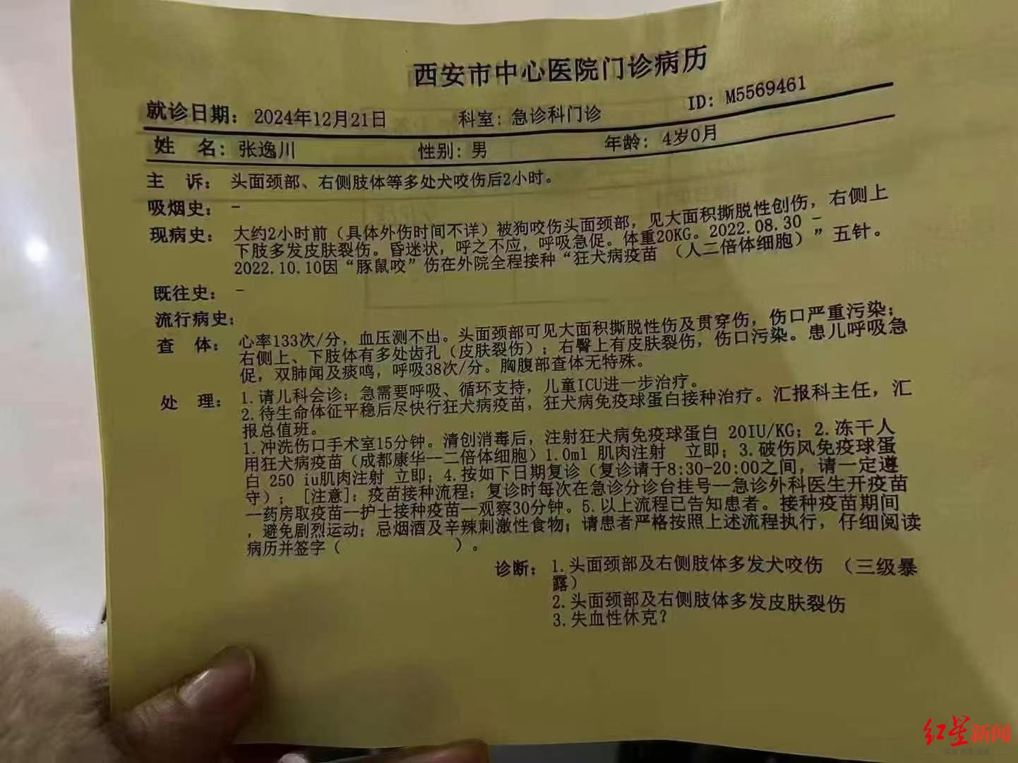 【 西安4岁男童遭恶犬袭击仍在ICU昏迷  警方尚未查明犬只来源】【 男童遭恶犬