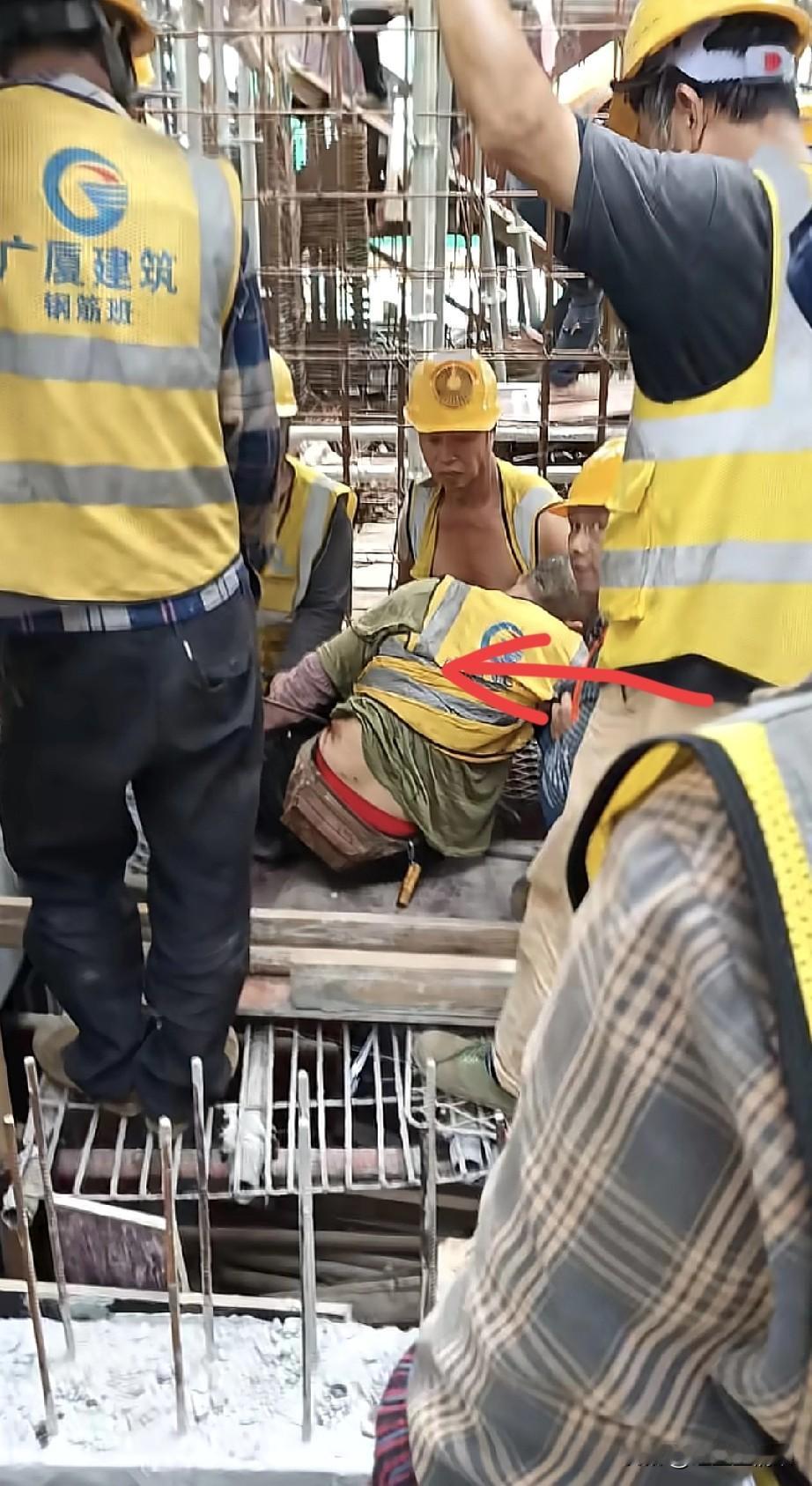 这位农民工太不幸了，在工地被钢筋刺穿腹部，看着有点严重啊。
欣慰的是，他的工友们
