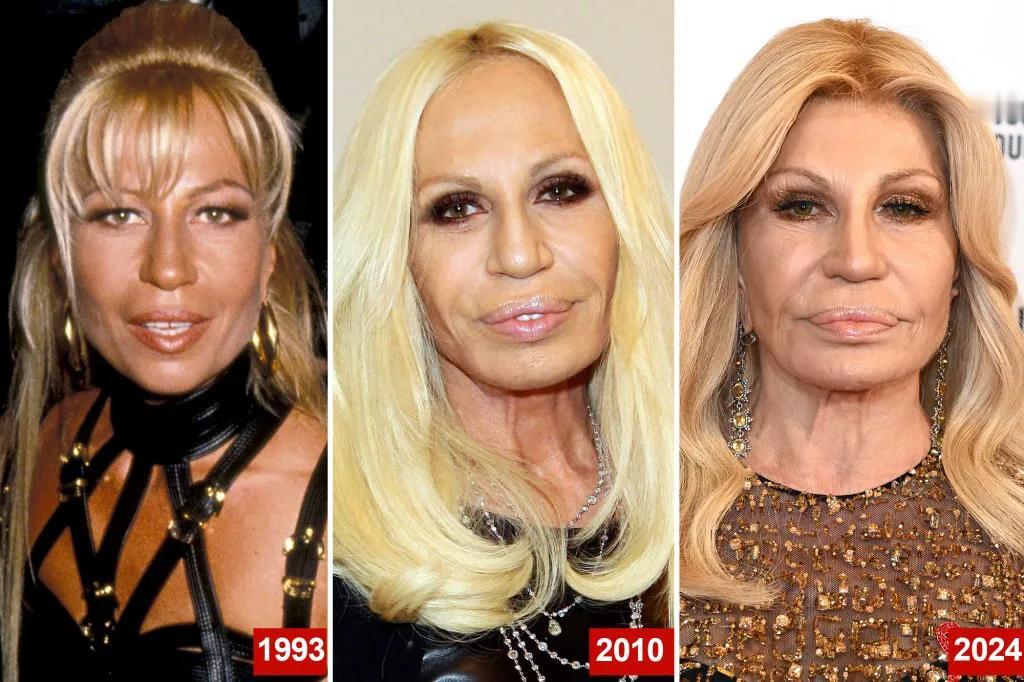 Donatella Versace 颜值回春变漂亮，靠的是多吃肉！
她之前太瘦了