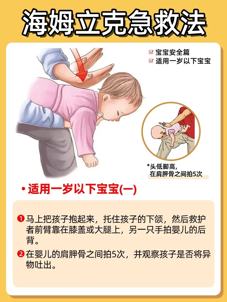 海姆立克急救法❗️一定要学⁉️异物卡喉怎么办