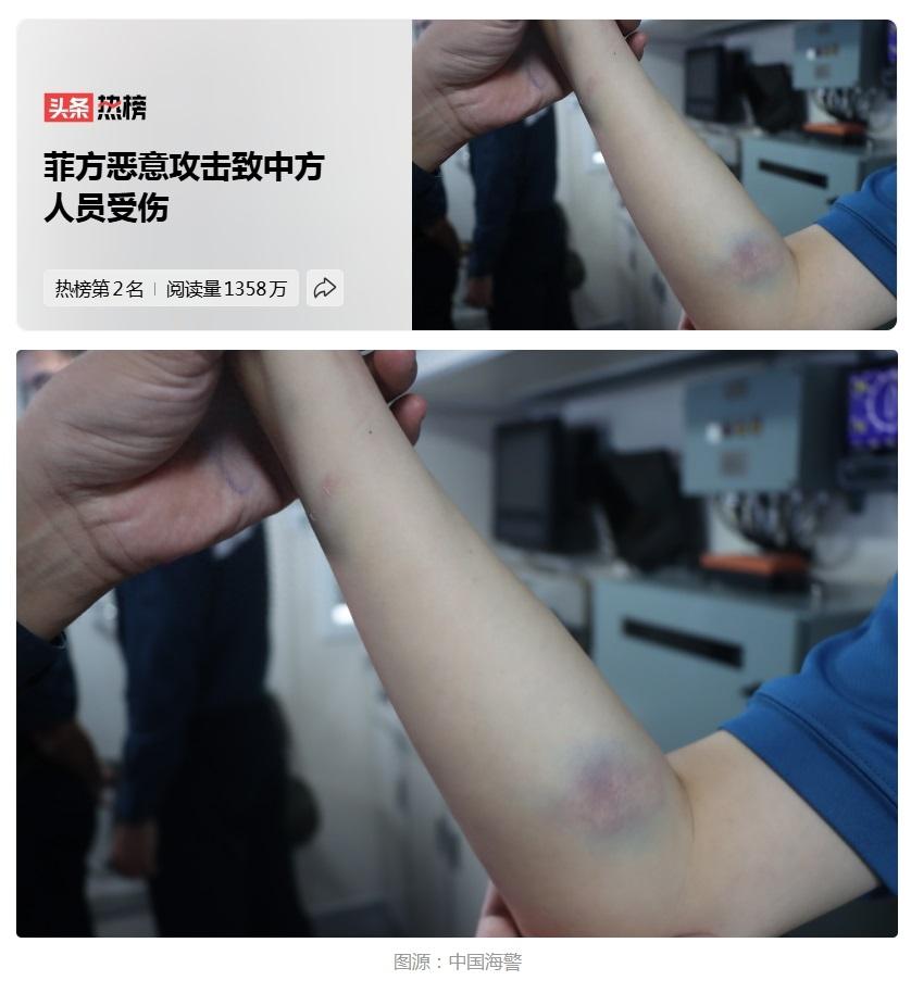 看完血压飙升！菲律宾拿长棍打伤我海警、转头卖惨装无辜，千算万算没算到中方手里有这