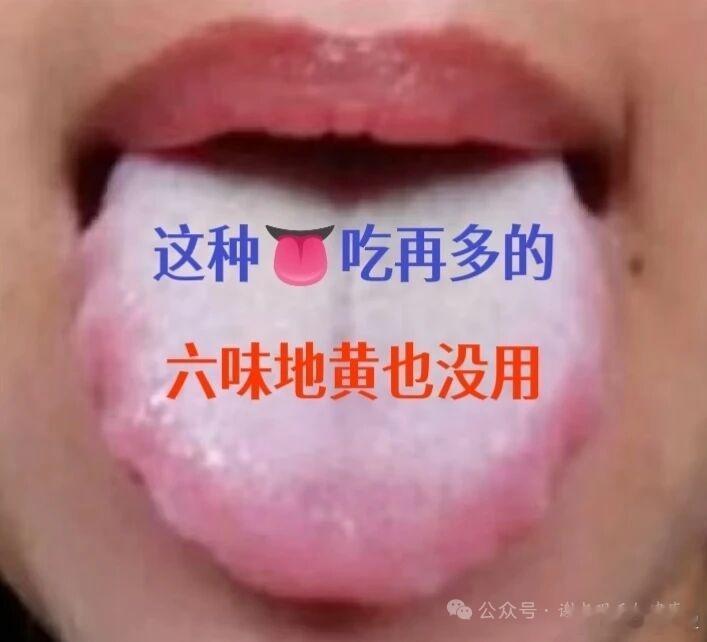 男题解不掉，不怕虚最怕堵！六味没用，这个药丸打通上下。前段时间碰到个小伙子，自述