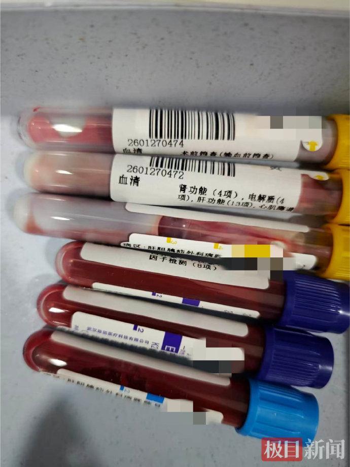 大学生寒假放纵吃喝抽出牛奶血【警惕！大学生寒假吃喝无节制，甘油三酯超标47倍，血