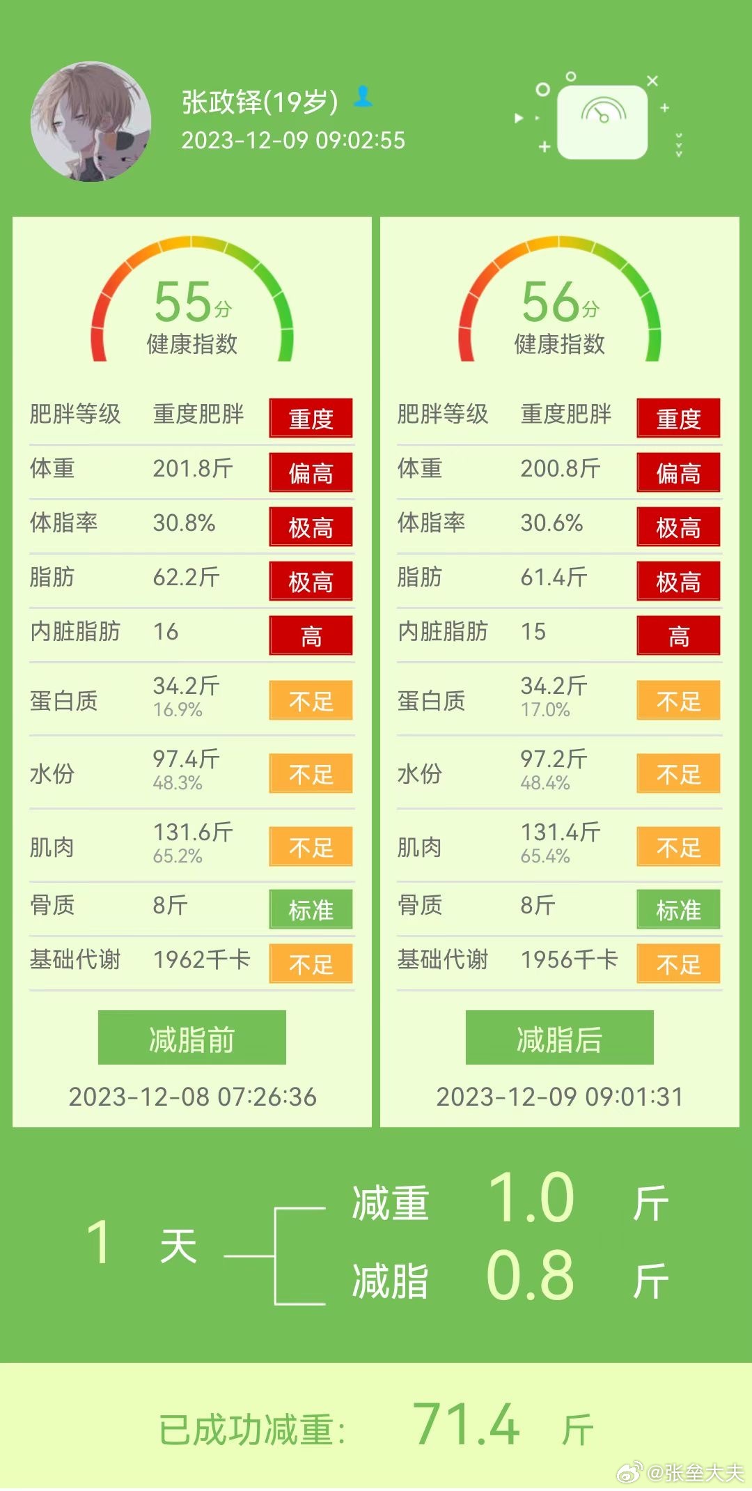 19岁的小伙子跟我们剪了71.4斤了，今天又减了1斤，71斤的肥肉什么概念？大半