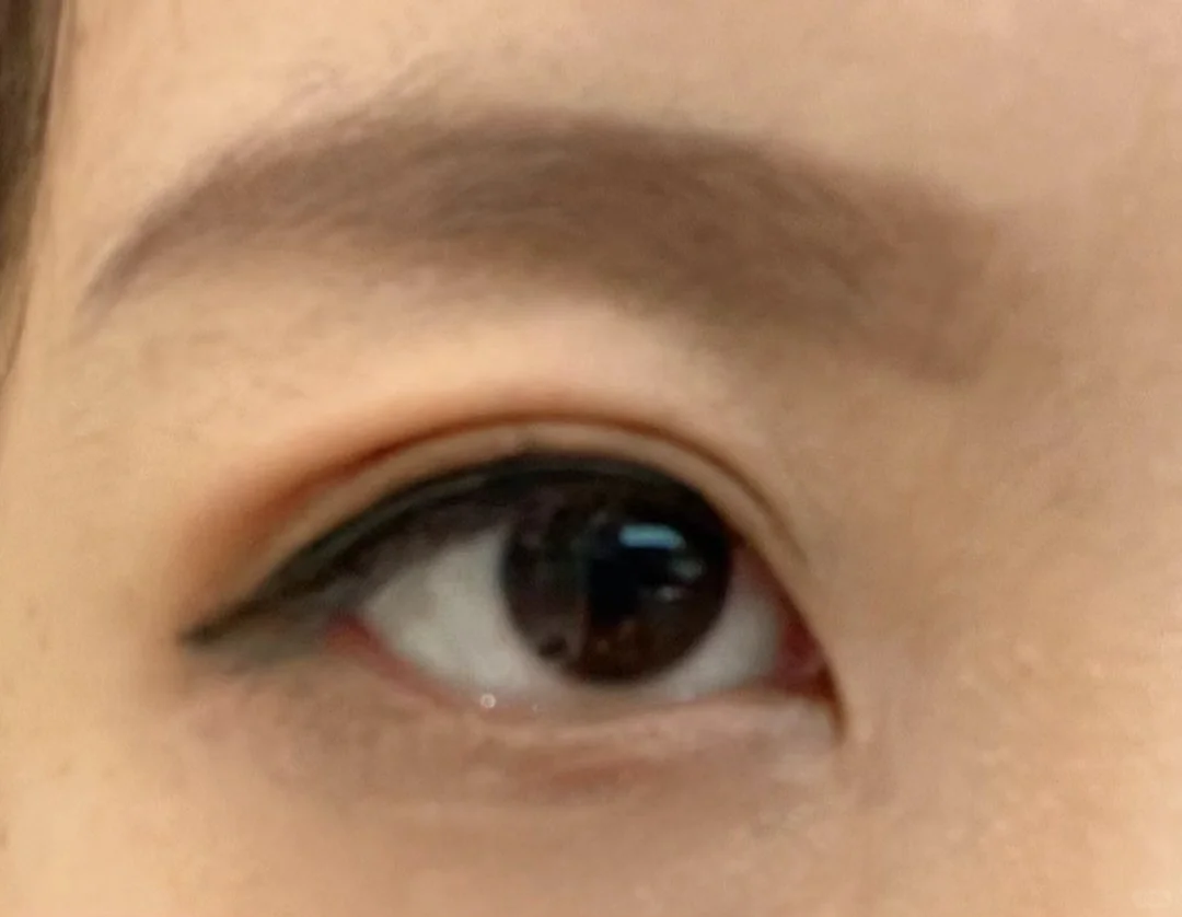 三白眼加有点斜视，看起来太反社会了