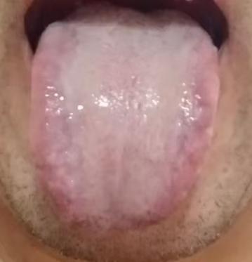 脾肾虚寒，阳气亏虚，精气无力充养宗筋






有粉丝留言说，自从身体出现相关