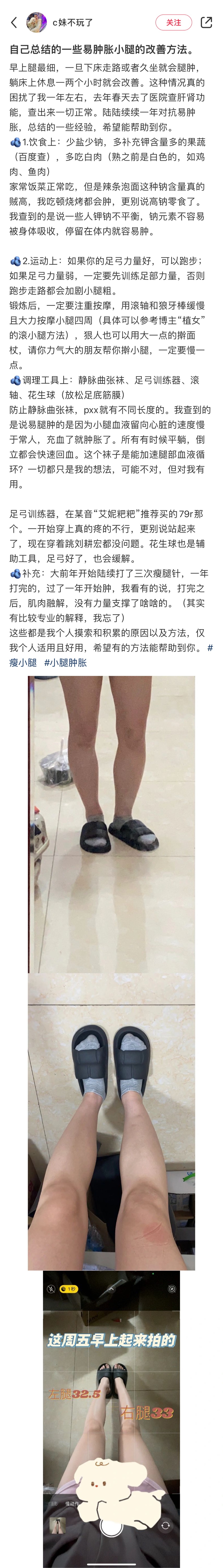 嗨💡水肿体质这里集合！早晚小腿容易肿胀其实是循环不畅通，收集了一些消水肿改善大