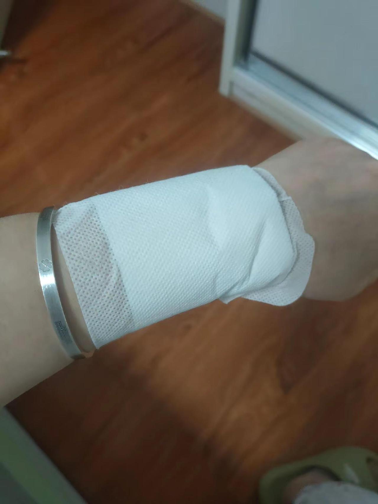 怎么会不疼，白天忍着干活。晚上回来贴膏药，没有按医生说的休息，所以一个多月了，一
