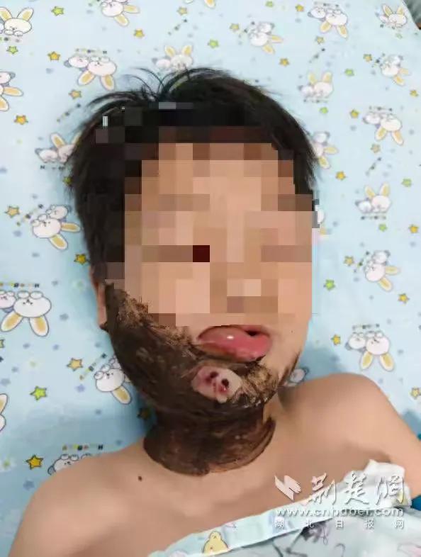 悲剧还是发生了！湖北襄阳，一8岁男童傍晚在浅滩踩水嬉闹时，一条细长黑影猛地从浑浊
