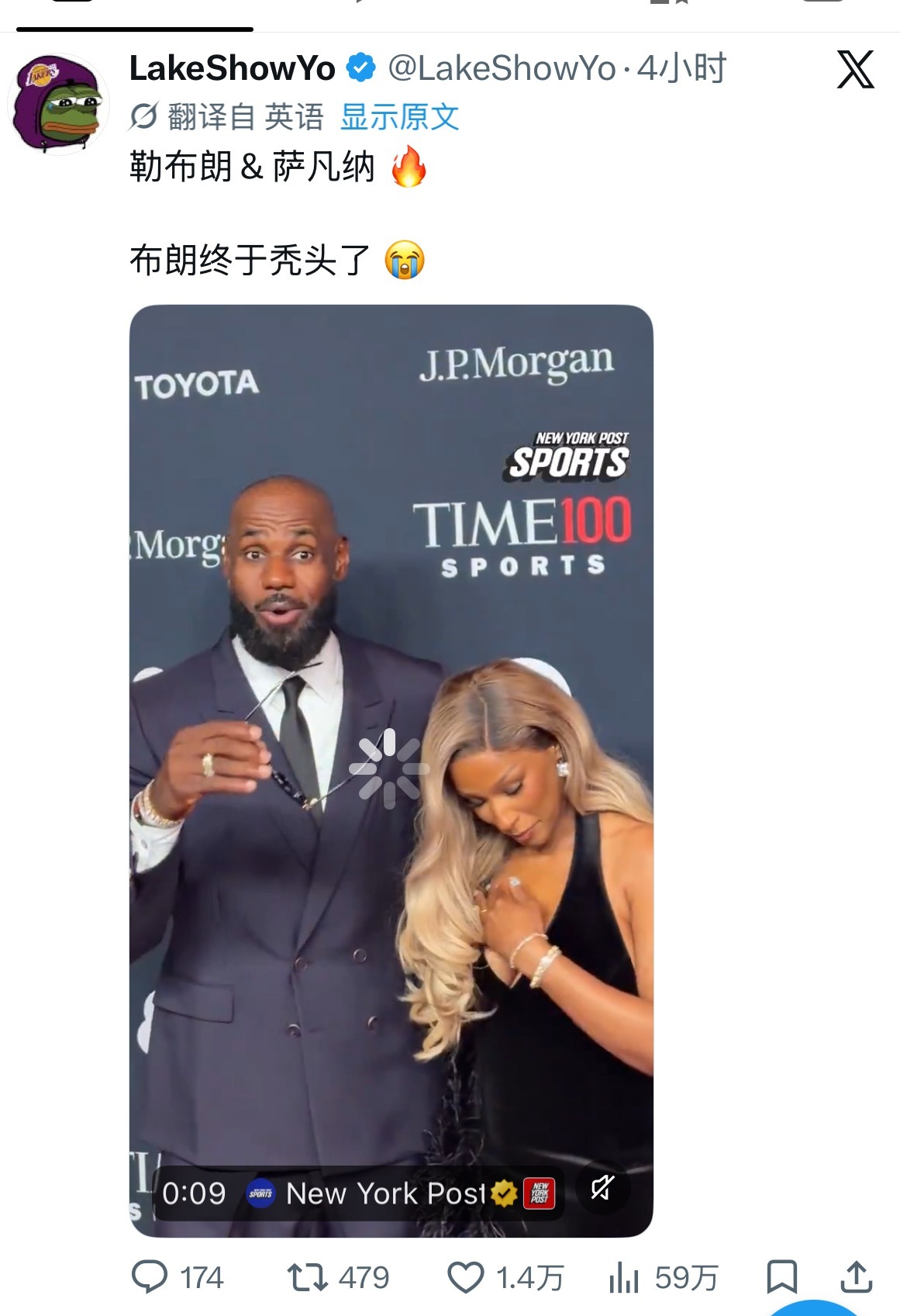 这个光头告诉我们 现在世界上的植发技术不可信 可以避免花冤枉钱 