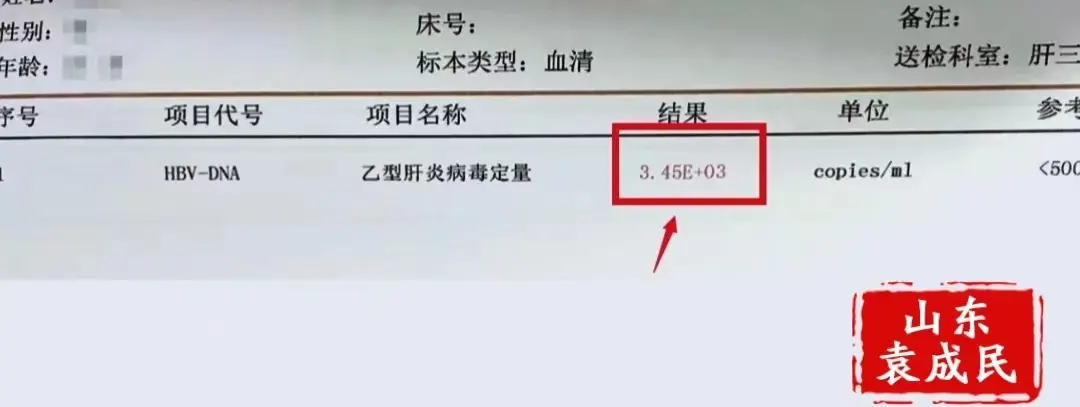 乙肝复查这5项检查不能少，小心病情恶化都不知道！ 1.肝功能，主要关注...