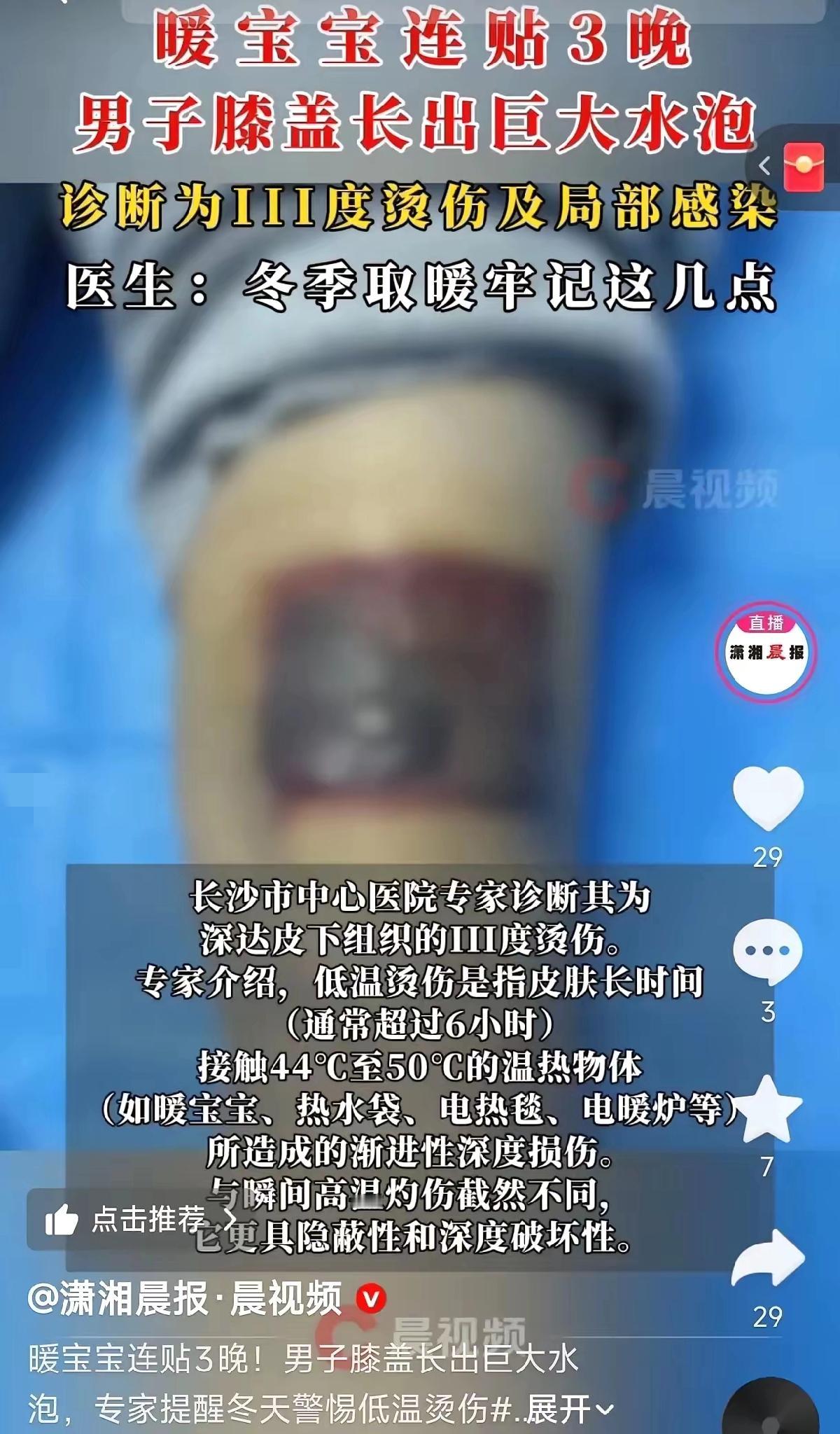 “悲剧还是发生了！”湖南长沙，一男子膝盖疼，为了缓解，直接在膝盖处贴了暖宝宝，贴