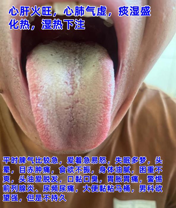 今天不忙，舌诊公益，继续来帮大家分析舌象：

如果有需要，尽管把你的舌象发过来