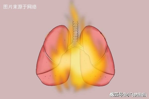 预防肺火应做到以下三点之1. 心态良好防上火：一是要保持内心宁静，培养乐观情绪，