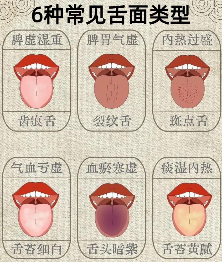 亚健康的舌面分6种，老中医教你自查身体状态！

我们中医舌诊是通过舌的颜色、形状