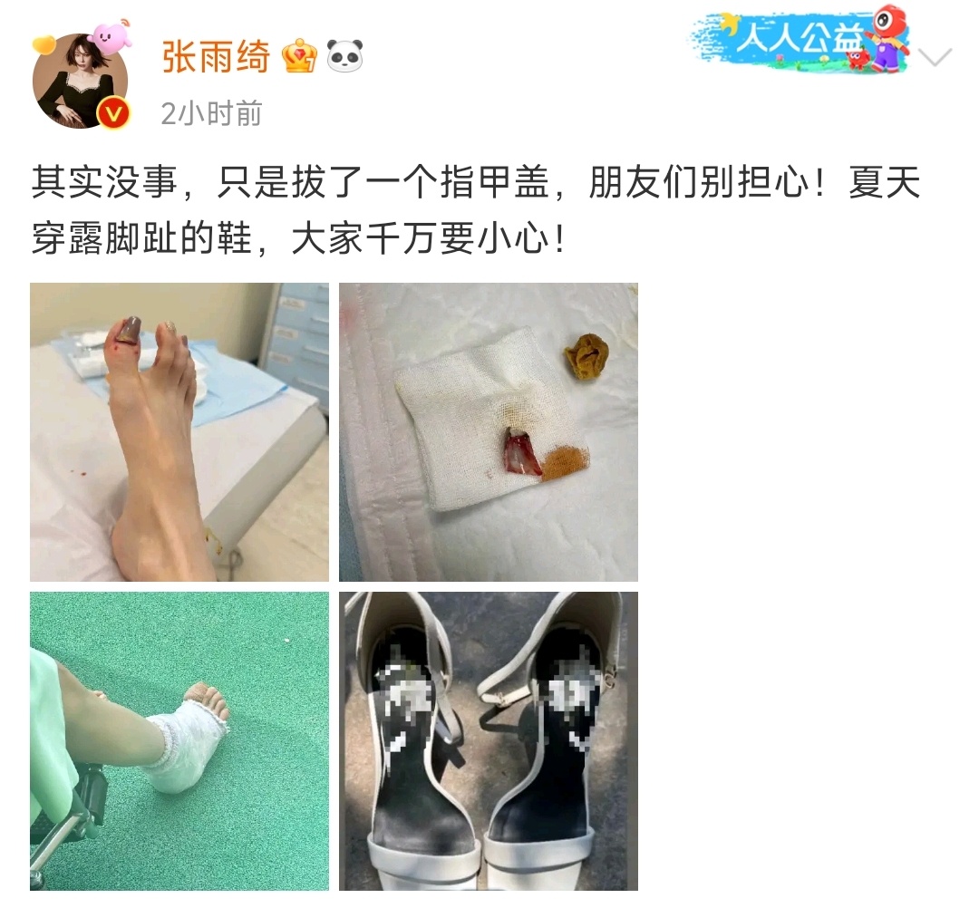 #张雨绮拔了一个脚指甲# 张雨绮拔了一个脚指甲盖，看到后一个激灵，这得多疼啊！她