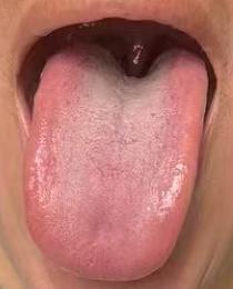 疏肝理气，气血畅达，身体状态更舒展





有些男同志上了年纪就出现了海绵体质