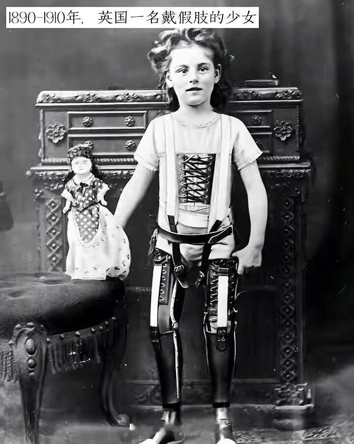 生活中，有不少装了假肢的少女勇敢地绽放光彩。3岁的杺禾生下来便右小腿缺失，患罕见